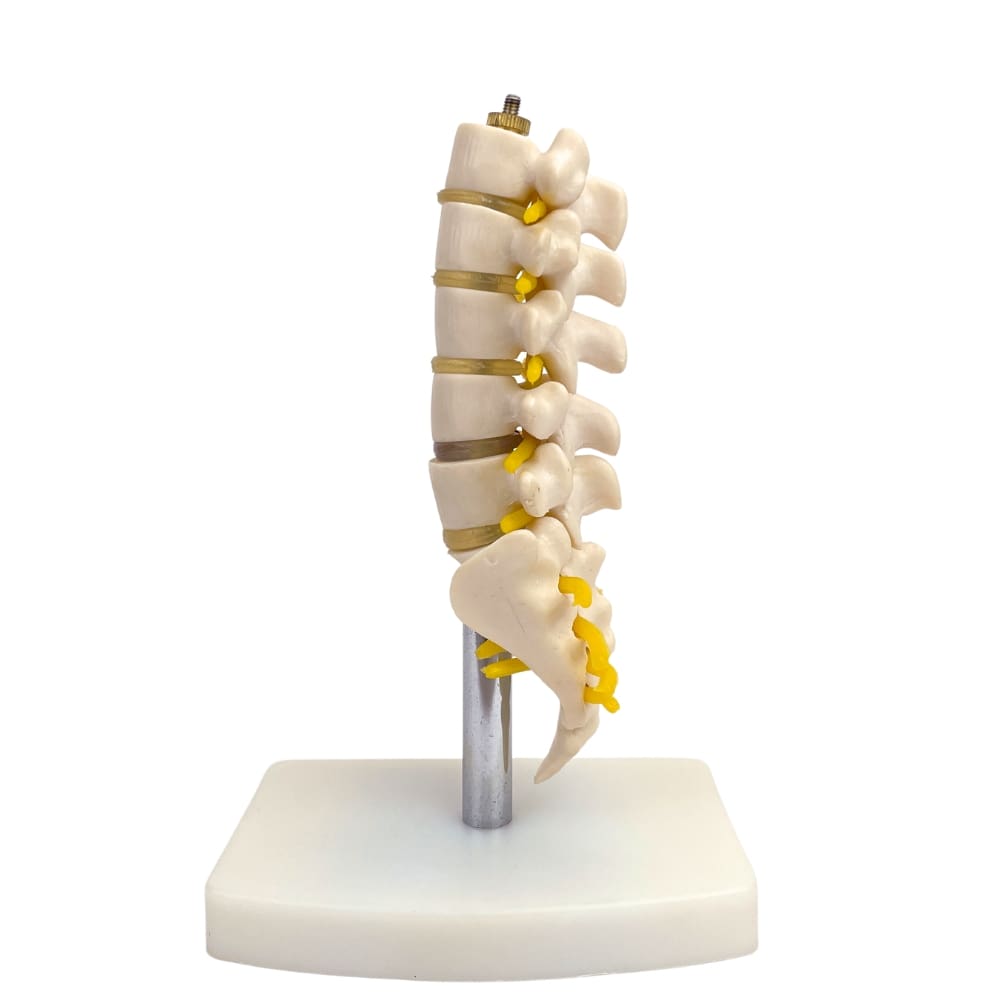 Modelo Vértebras Lumbares con Hernia de Disco - Image 3